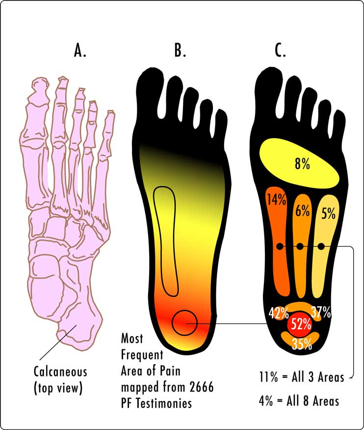 Best Running Shoes for Plantar Fasciitis 2